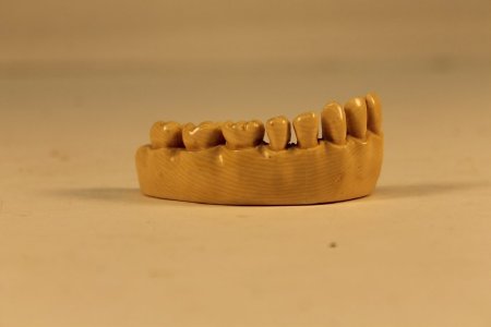 False Teeth                             